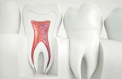 Root Canal Treatment