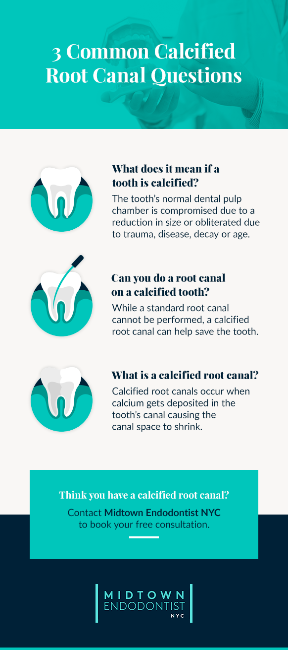 Calcified Root Canal FAQ