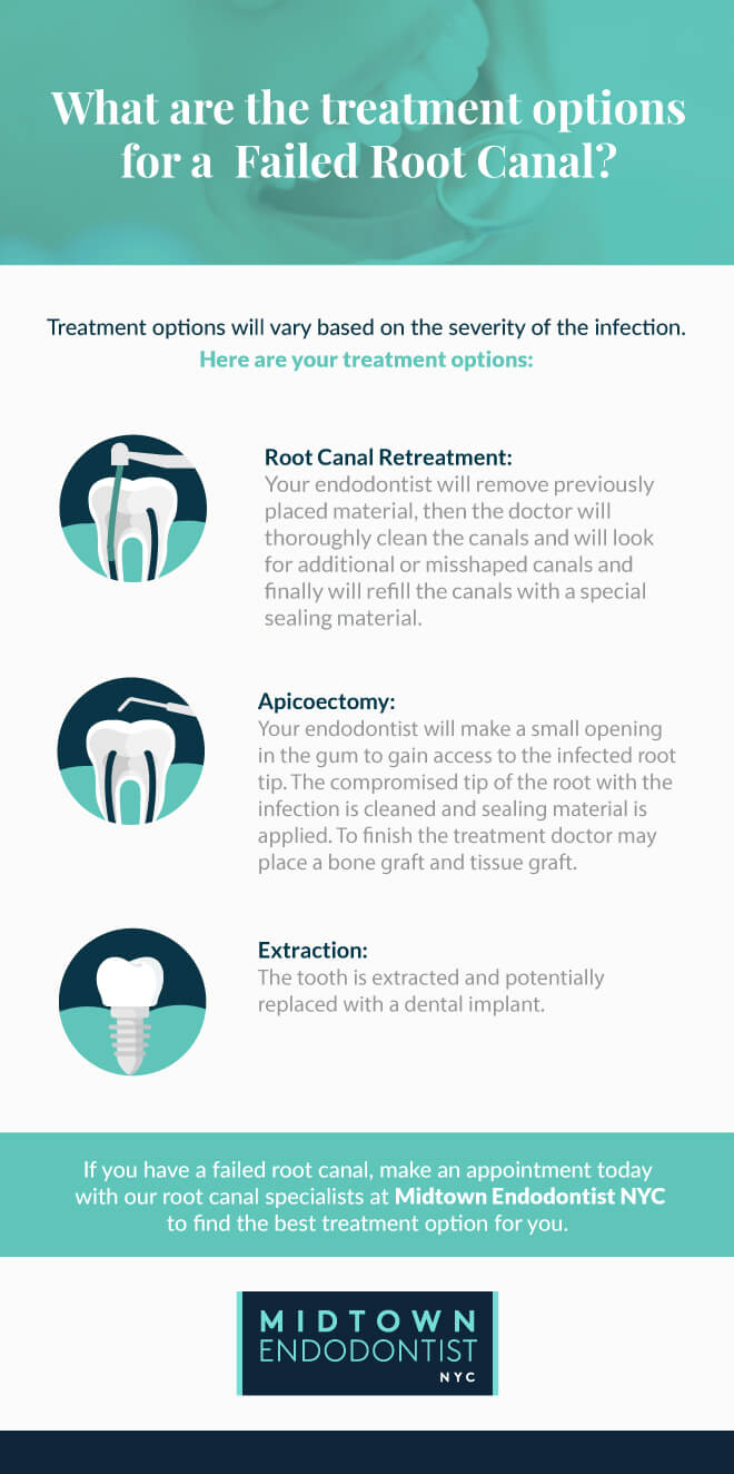 Failed Root Canal