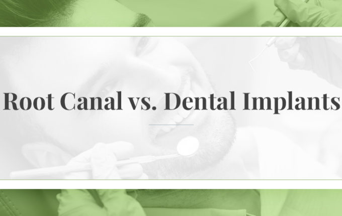 Root Canal vs. Dental Implants