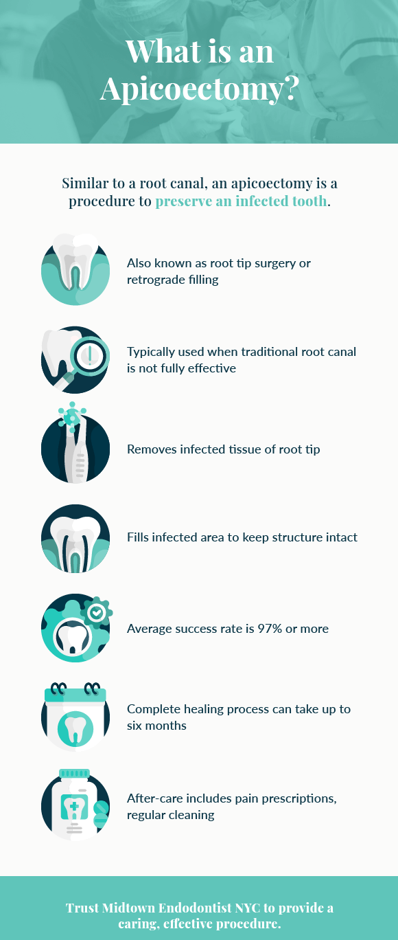 infographic of apicoectomy as a step by step process