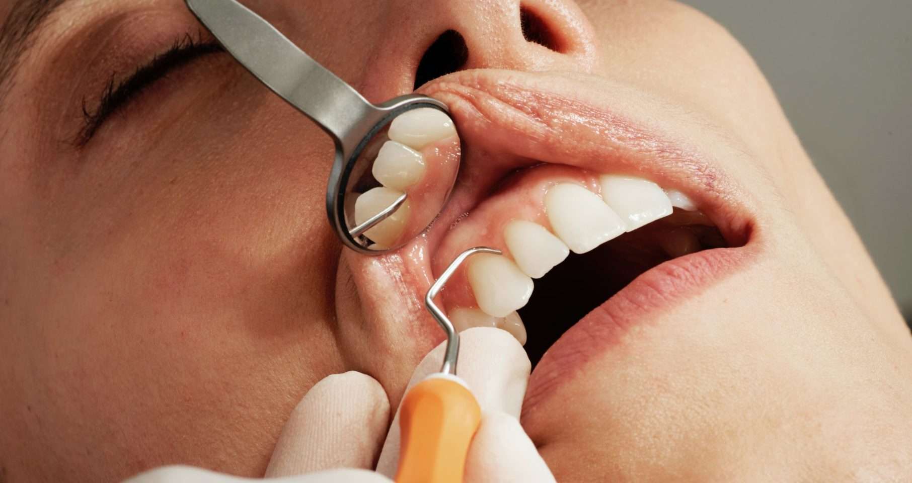Root Canals and Health Problems
