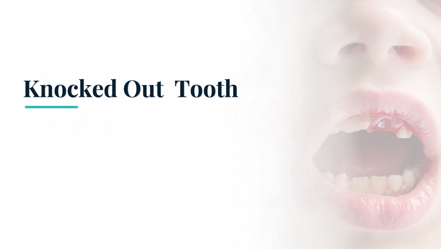 knocked out tooth