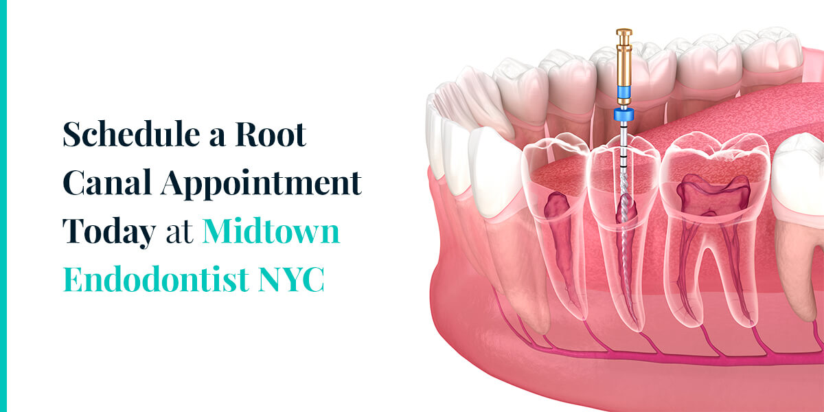Schedule a Root Canal Appointment Today