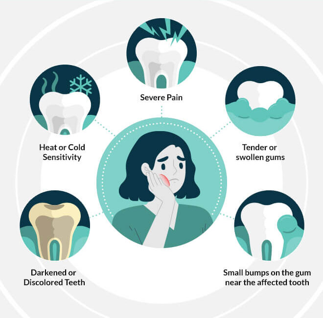 Signs of Dead Tooth