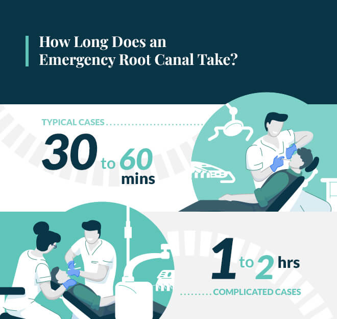 how long does an emergency root canal take